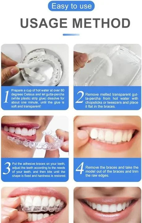 Smile Veneers | ابتسامة الفينيرز التجميلية